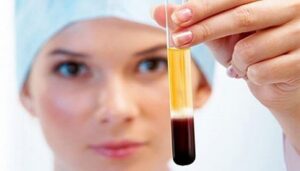 PRP treatment in Istanbul