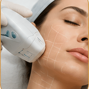 HIFU treatment in Istanbul